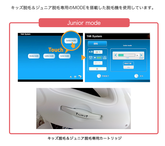 ジュニア脱毛専用のMODEを搭載さいた脱毛機